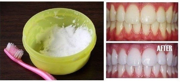 DIY Natural Teeth Whitening in Minutes at Home (Video)