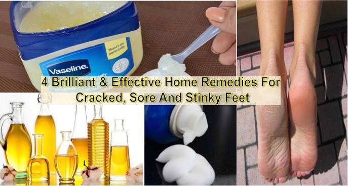 4 Effective Home Remedies for Sore, Cracked and Stinky Feet