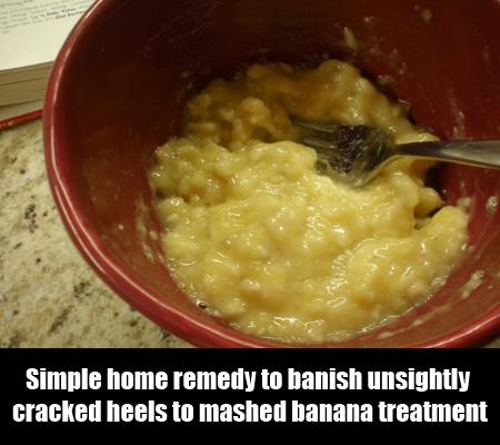 4 Effective Home Remedies for Sore, Cracked and Stinky Feet5