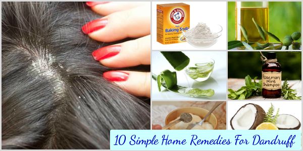 Fab Art DIY Simple Home Remedies For Dandruff