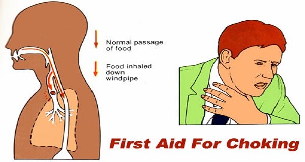 Choking first aid - How to Save Yourself If You Are Choking Alone