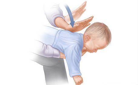 How to Save a Baby That Is Choking- Newest Advice From Doctors (Video)