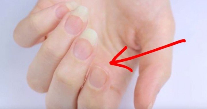 The Secret To Fix A Broken Nail FAST
