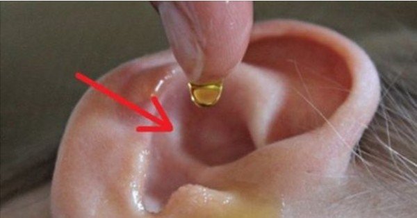 Home Remedy Against Earwax & Ear Infections