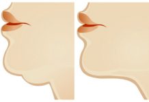 Simple Exercises to Get Rid Of Double Chin Fast Simple Exercises to Get Rid Of Double Chin Fast