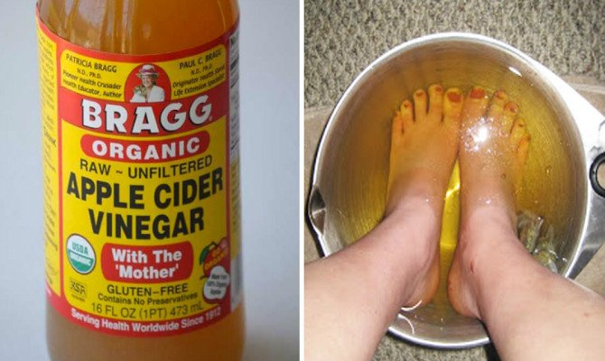 16 Beauty Uses of Apple Cider Vinegar